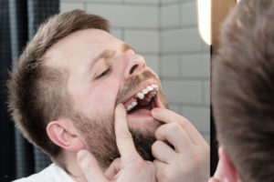 Dental Patient Missing His First Top Premolar